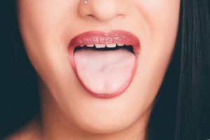 9 Lucruri pe care limba le spune despre sănătatea ta